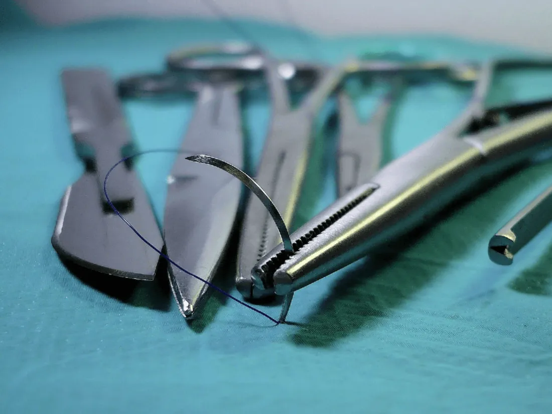 Chirurgie