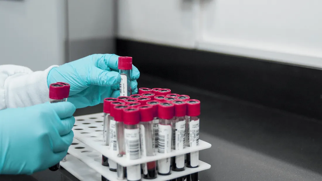Les laboratoires d’analyses médicales en grève à compter de ce lundi 14 novembre