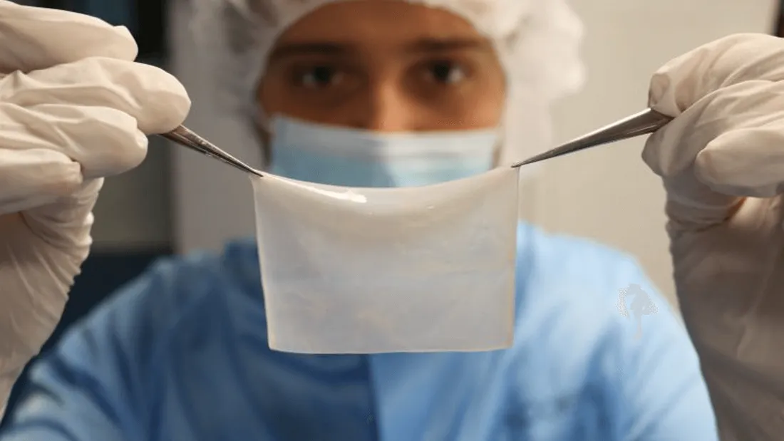 Une peau artificielle créée par une entreprise de Gironde testée à Marseille