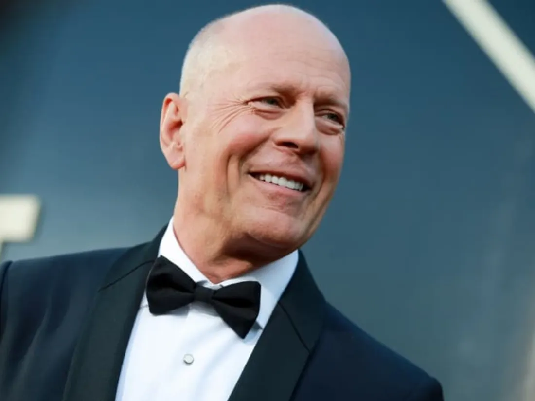 Bruce Willis souffre de DFT