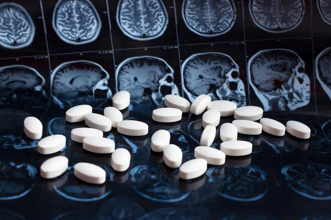 L'Agence européenne des médicaments approuve un traitement contre Alzheimer