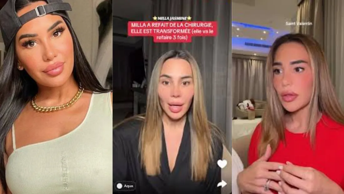 Milla Jasmine : méconnaissable après la chirurgie, son nouveau visage surprend les internautes