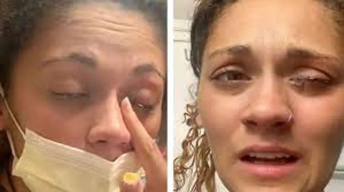 L'erreur virale sur TikTok : quand elle confond la superglue avec des gouttes pour les yeux !