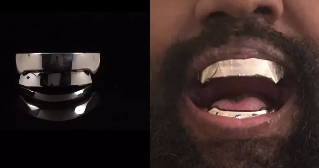 Kanye West n’a pas retiré ses dents pour une prothèse en titane à 850 000 $