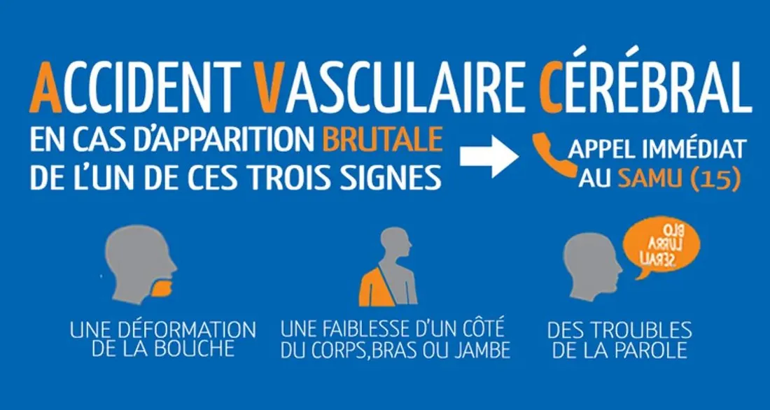 Signes à surveiller pour un AVC