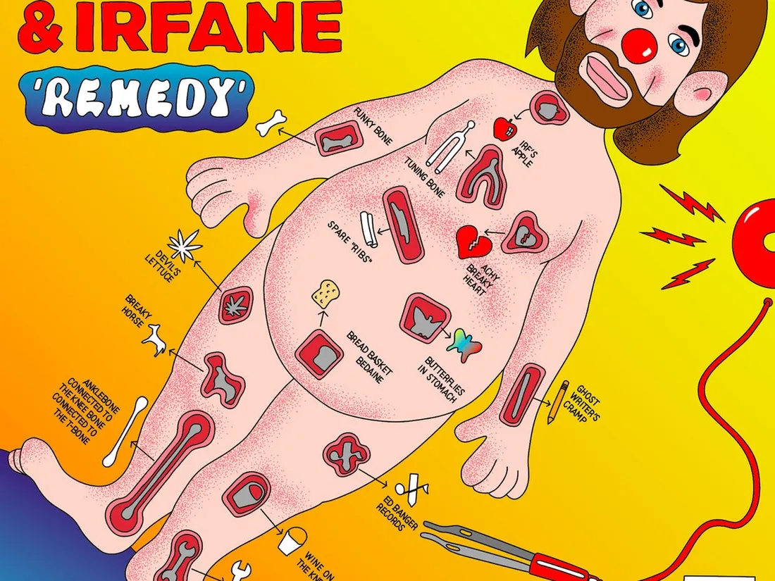 Image d'illustration