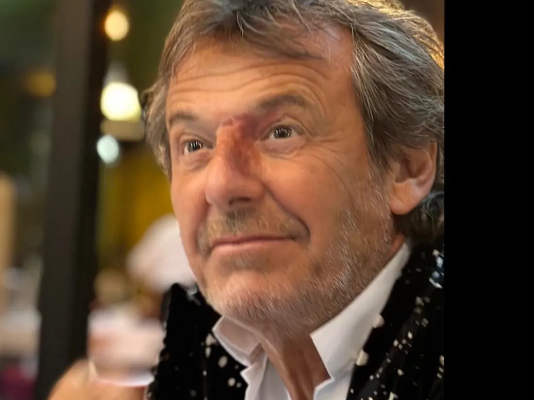 Des cambrioleurs tentent de pénétrer chez Jean-Luc Reichmann