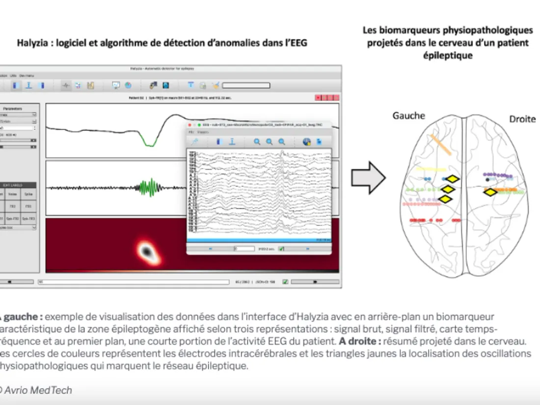 Exemple de visualisation des données dans l’interface d’Halyzia