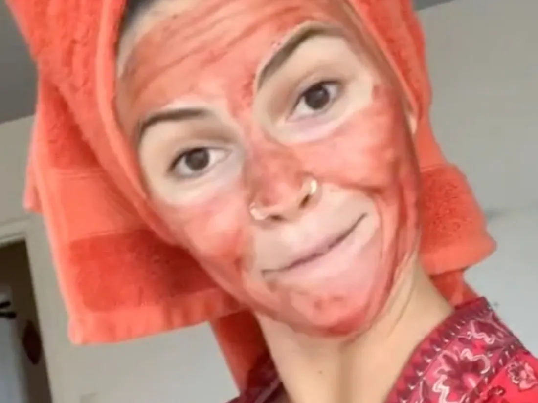 Utiliser le sang des règles en guise de masque pour le visage ? La tendance qui secoue la toile !