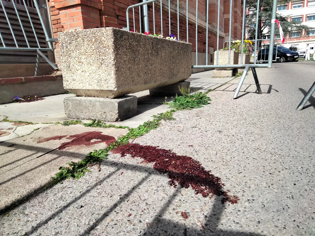 Agression au couteau à l'hôpital de Montauban - Bâtiment 