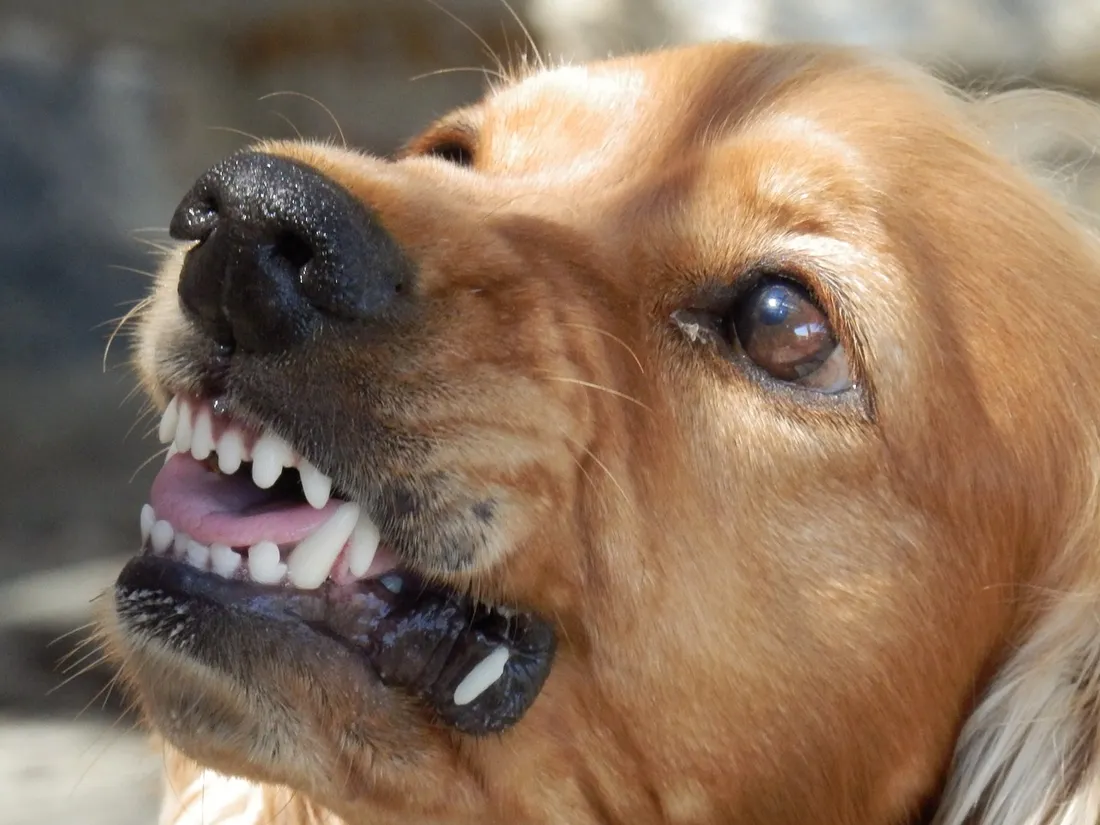 Vernon : une fillette attaquée par un chien