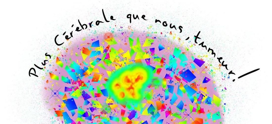 Crédit : Plus cérébral que nous, tumeur !