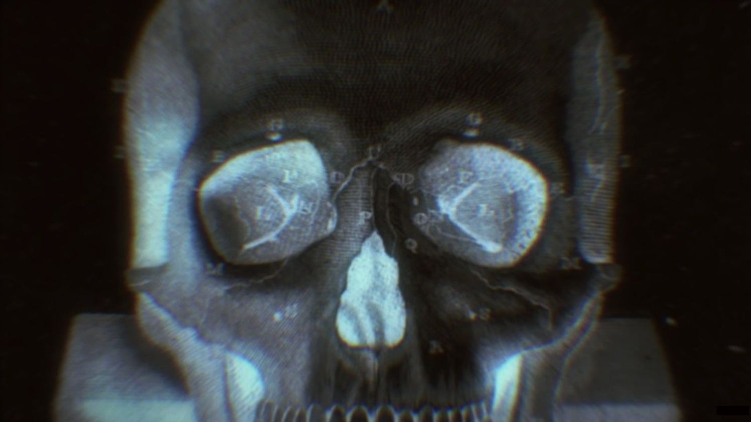Bones Imagine Dragons