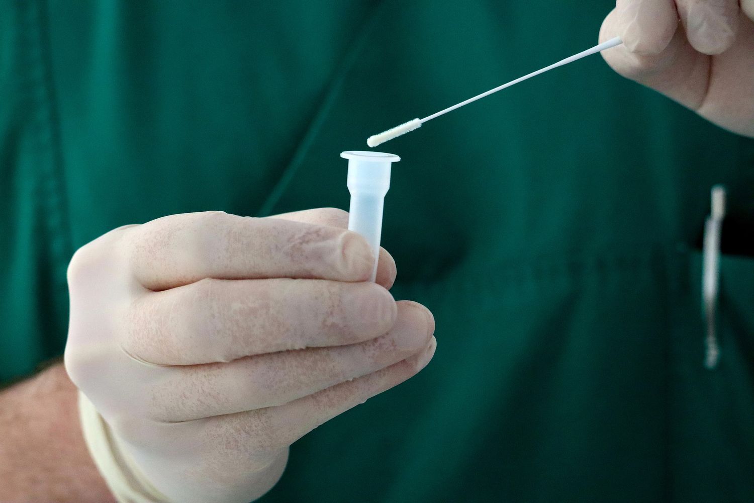 Après 78 Tests en 2 ans, un homme est toujours positif au Covid-19