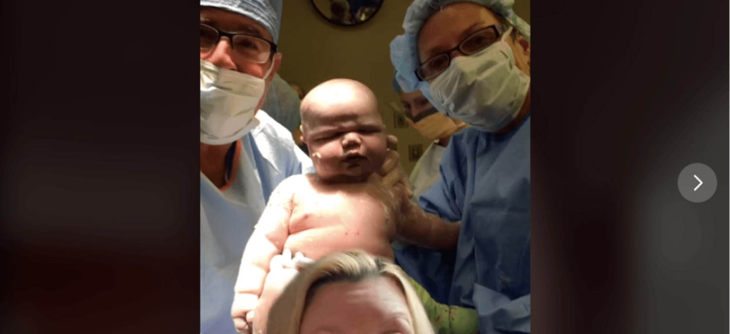 Une Femme Accouche D Un Bebe De 6 Kilos Video