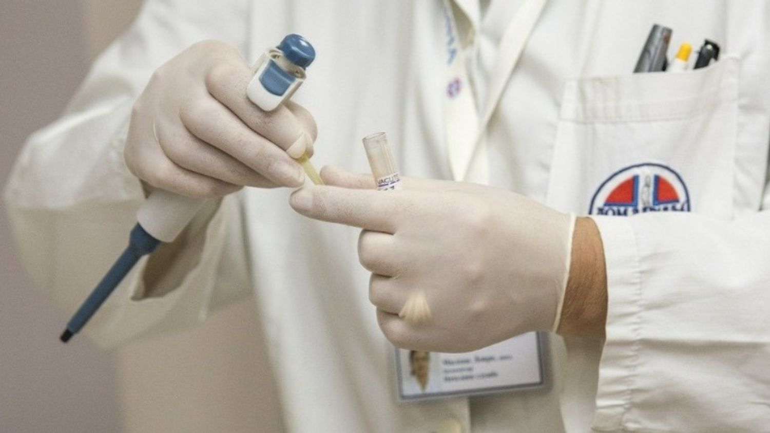 16 cas de variole du singe recensés en Nouvelle-Aquitaine
