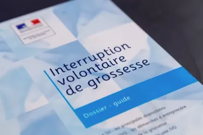 IVG
