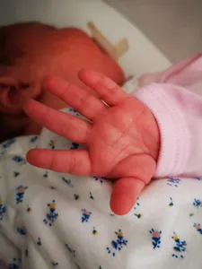De moins en moins de bébés en Eure-et-Loir