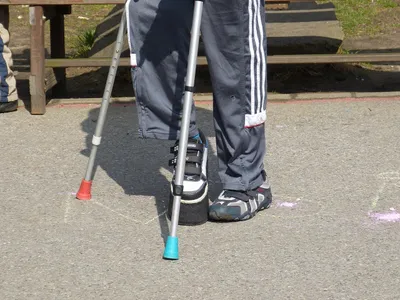Une journée d'échanges par l'APF France handicap d’Eure-et-Loir