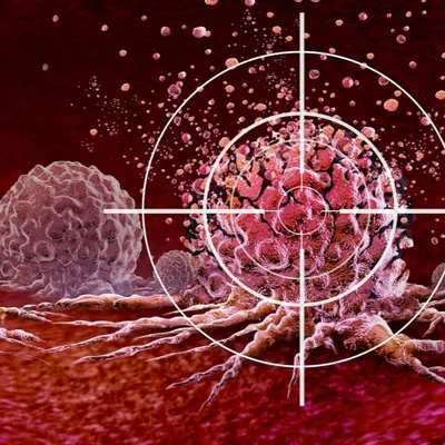 [ SANTE - FRANCE ] Une nouvelle arme contre les cancers résistants...