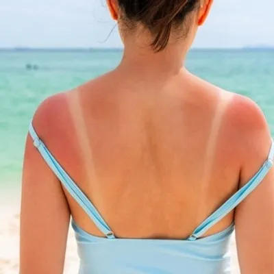 C’est une tendance dangereuse... Les « Sun tattoo » dans le viseur...