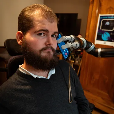 Un bras bionique pour gagner en autonomie face au handicap