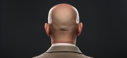 Selon une étude, les hommes chauves sont plus séduisants et plus...
