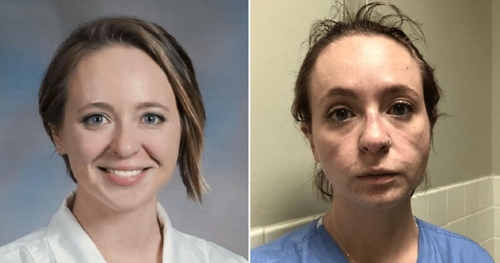 Une infirmière montre des photos d’elle prises avant et après avoir...