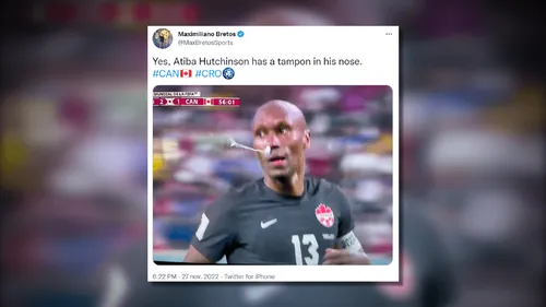 Coupe du monde : un footballeur canadien joue avec un tampon dans...