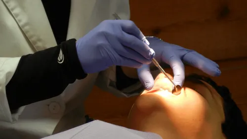 Un adolescent indien se fait retirer 82 dents 