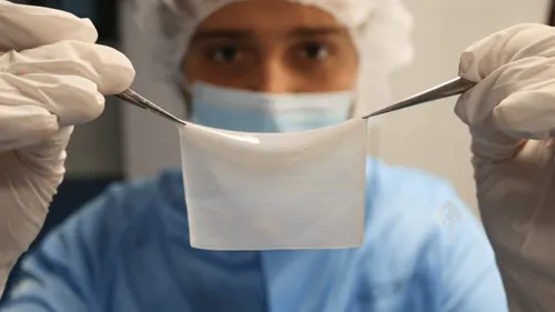 Greffe d'une peau imprimée en 3D : premiers essais cliniques à...