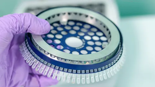 Belgique : un laboratoire confond résultats positifs et négatifs