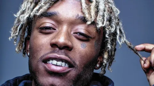 Lil Uzi Vert a retiré de son front son dimant à 24 millions de...