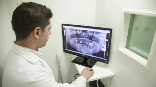 Complémentaires santé : la Mutualité Française annonce une hausse...