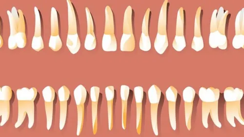 Santé : remplacer une dent arrachée par une nouvelle dent cultivée 