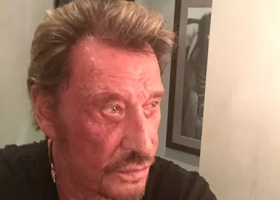 Johnny Hallyday atteint d'un cancer ?