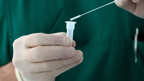 Covid-19 : un homme confiné pendant 14 mois après 78 tests positifs !