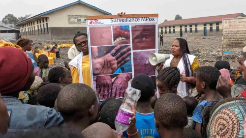 Mpox : la République Démocratique du Congo espère recevoir les...