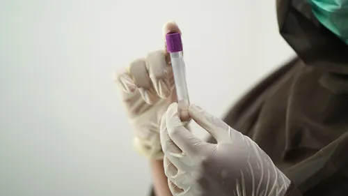 Pas ou peu d'analyses ce week-end : les laboratoires médicaux en grève