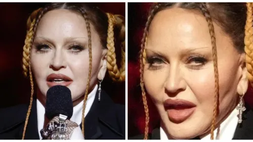 Madonna : son nouveau visage inquiète !
