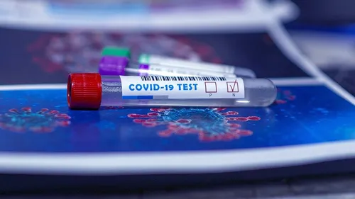 Le Conseil Constitutionnel valide le Pass Sanitaire
