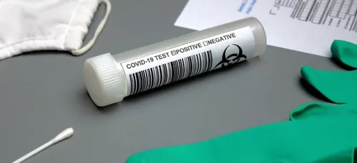 Covid-19 : fortement décrié en Chine, le test anal serait jugé plus...