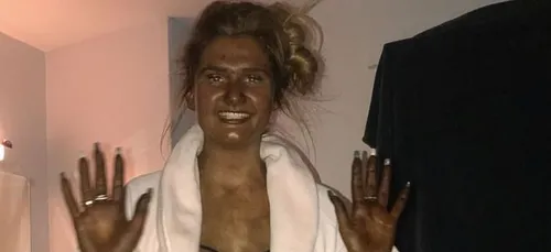 Une femme devient « verte » après avoir abusé de l’autobronzant !...