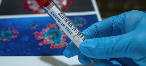 Covid-19 : il lui fait un test nasal, puis c’est le coup de foudre !