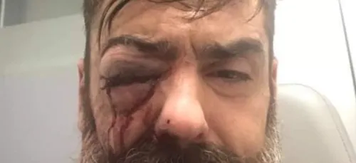 Jérôme Rodrigues annonce qu’il va perdre son œil