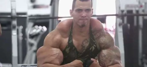 Vouloir ressembler à Hulk peut coûter un bras...