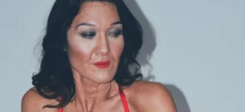 Atteinte d'une maladie très rare, cette jeune femme parait beaucoup...