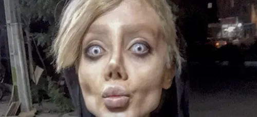 Elle entreprend 50 opérations afin de ressembler à Angelina...