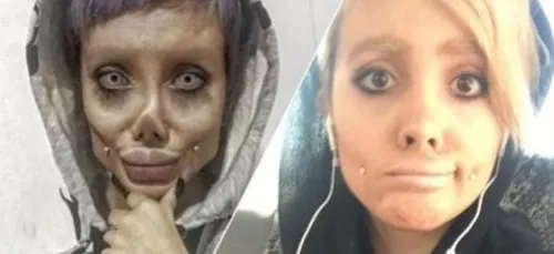 La jeune femme prête à tout pour ressembler à Angelina Jolie était...