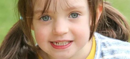 A cause de la varicelle, une fillette de 4 ans a failli mourir !